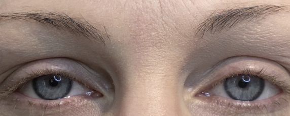 Eyebrow-Client-4-Before-