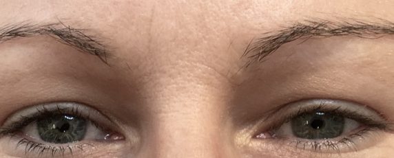 Eyebrow-Client-5-Before-