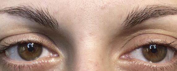 Eyebrow-Client-Before-