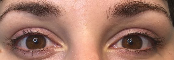 Eyeliner-Client-4-Before-